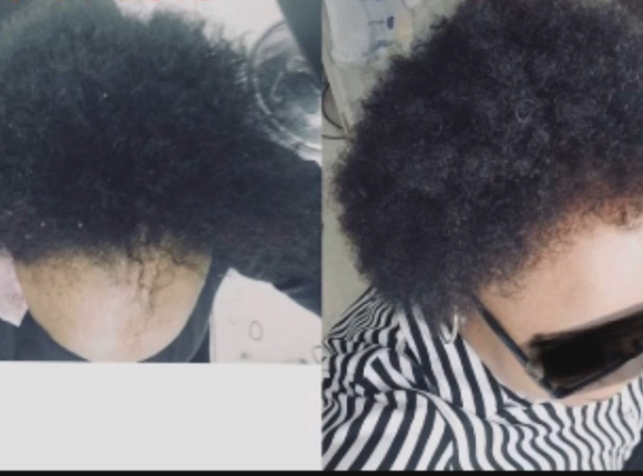 The True Root Hair Growth Oil ”Extra Strength
