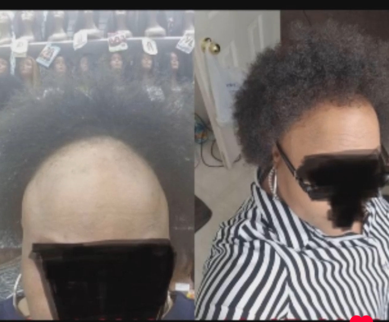 The True Root Hair Growth Oil ”Extra Strength
